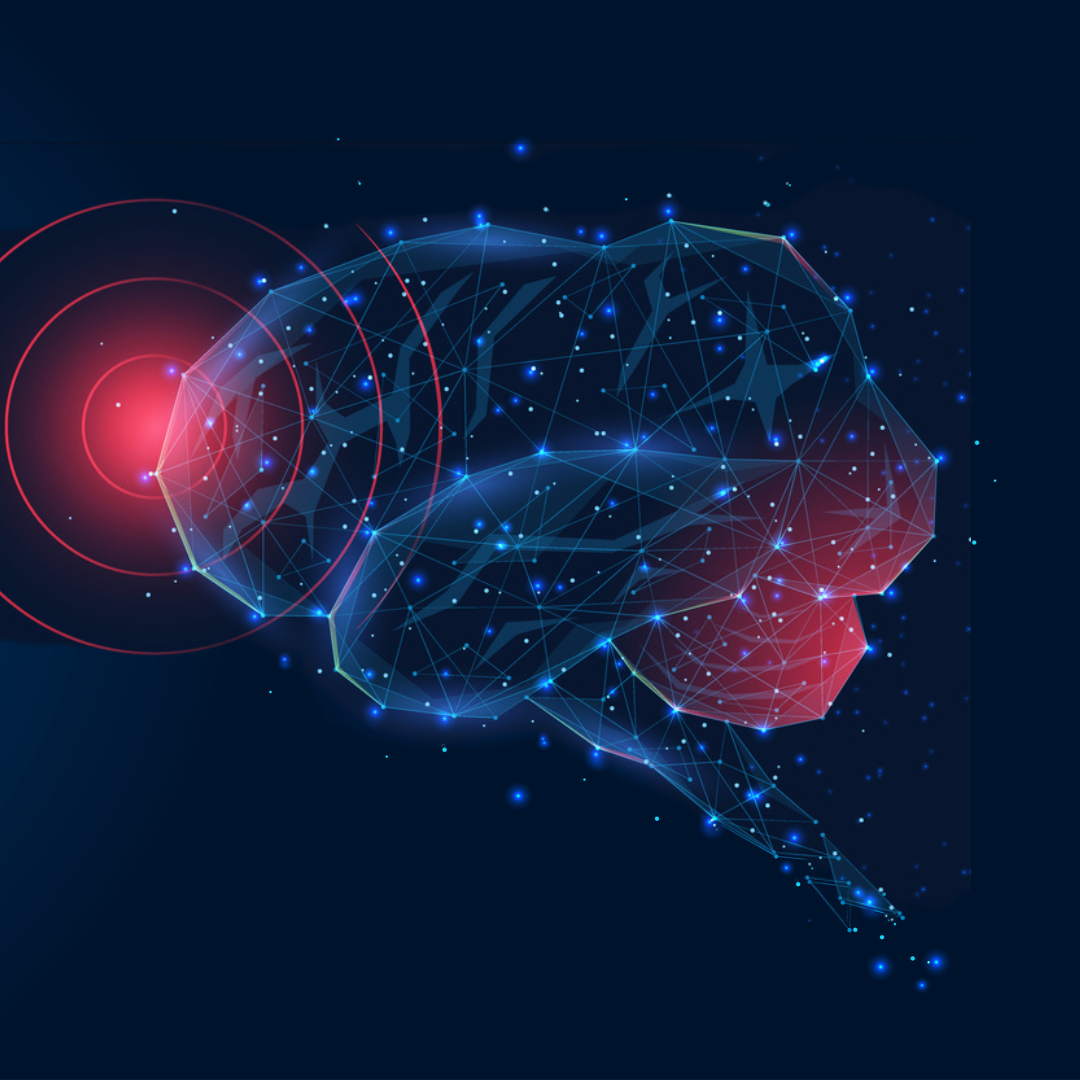 Concussion