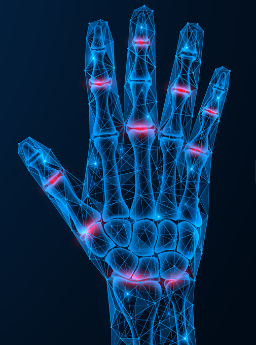 FingerHandWrist-Pain