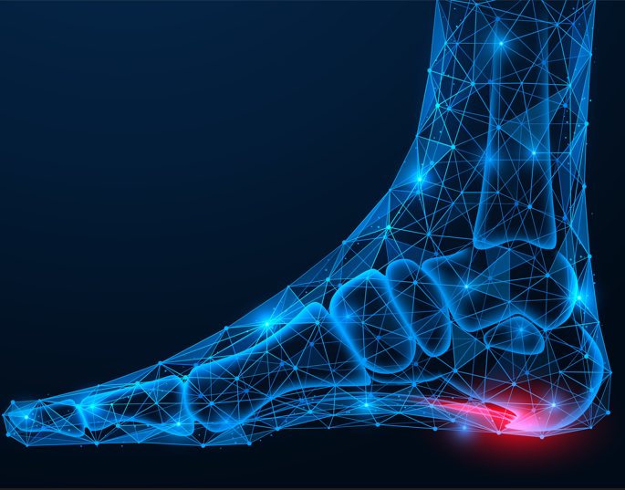 Heel-Pain