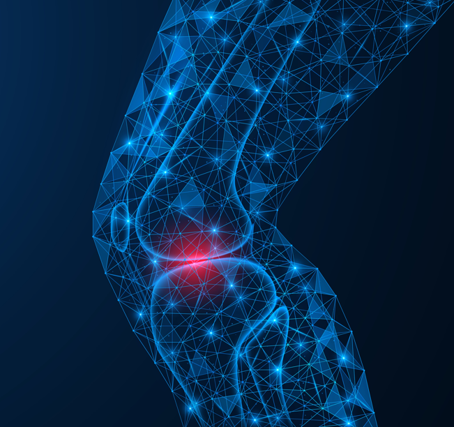 Knee-Pain