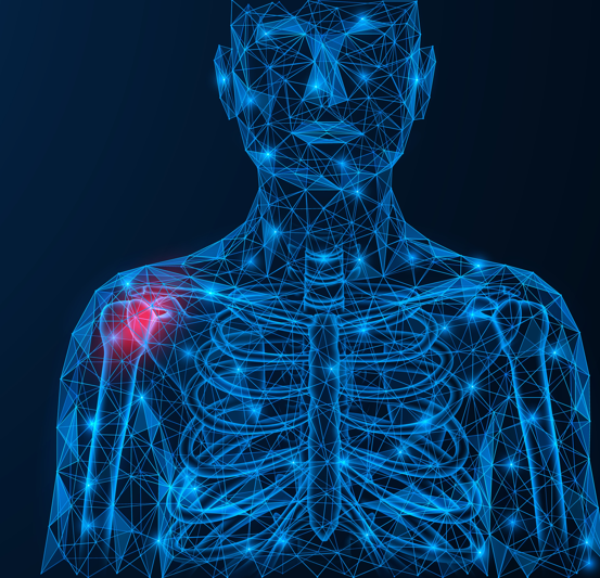 Shoulder-Pain